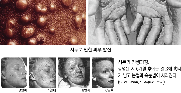 6  ,6  ,4  ,3  ,                6                                 (C  W  Dixon, Smallpox, 1962 